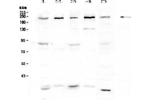 Western blot analysis of ASXL1 using anti-ASXL1 antibody .