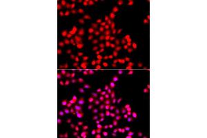 Immunofluorescence analysis of A549 cell using TTBK2 antibody. (TTBK2 抗体)