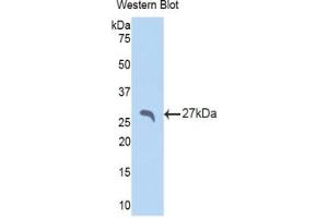 Detection of Recombinant SAP, Rat using Polyclonal Antibody to Serum Amyloid P Component (SAP) (APCS 抗体  (AA 22-222))