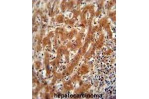 Immunohistochemistry (IHC) image for anti-Pyruvate Kinase (PK) antibody (ABIN2922768) (Pyruvate Kinase 抗体)
