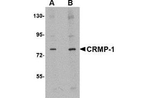 Western Blotting (WB) image for anti-Collapsin Response Mediator Protein 1 (CRMP1) (N-Term) antibody (ABIN1031328) (CRMP1 抗体  (N-Term))