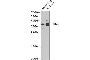 Western blot analysis of extracts of various cell lines using TPM4 Polyclonal Antibody at dilution of 1:1000. (Tropomyosin 4 抗体)