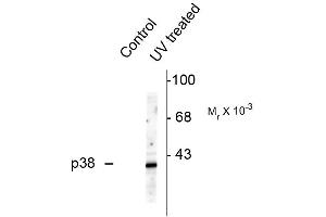 Western blots of HeLa cell lysates that had been treated with UV or untreated (Control) showing specific immunolabeling of the ~39k p38 MAPK protein phosphorylated at Thr180 and Tyr182 . (MAPK14 抗体  (pThr180, pTyr182))