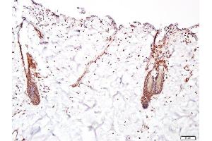 Paraformaldehyde-fixed, paraffin embedded human skin, Antigen retrieval by boiling in sodium citrate buffer (pH6. (FGFR2 抗体  (AA 21-120))