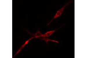ABIN6274519 staining Hela cells by IF/ICC. (DCP1A 抗体  (Internal Region))
