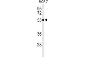 Western Blotting (WB) image for anti-Pre-mRNA Processing Factor 19 (PRPF19) antibody (ABIN3002151) (PRP19 抗体)