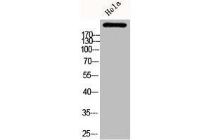 Western Blot analysis of HELA cells using Phospho-ACCα (S80) Polyclonal Antibody (Acetyl-CoA Carboxylase alpha 抗体  (pSer80))