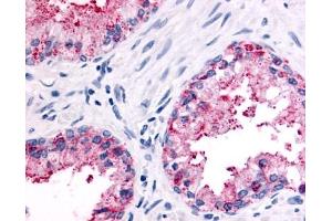 Immunohistochemistry (IHC) image for anti-Olfactory Receptor, Family 51, Subfamily E, Member 2 (OR51E2) (N-Term) antibody (ABIN122638)