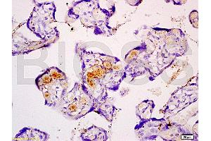 Formalin-fixed and paraffin embedded human placenta tissue with Anti-Fibulin 5 Polyclonal Antibody (ABIN728473), Unconjugated at 1:200, followed by conjugation to the secondary antibody and DAB staining