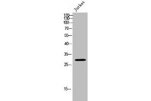 Western Blot analysis of JK cells using Med8 Polyclonal Antibody (MED8 抗体  (Internal Region))