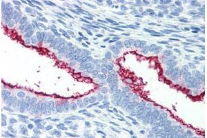 Human Uterus (formalin-fixed, paraffin-embedded) stained with MUC16 antibody ABIN351551 at 10 ug/ml followed by biotinylated anti-mouse IgG secondary antibody ABIN481714, alkaline phosphatase-streptavidin and chromogen. (MUC16 抗体)