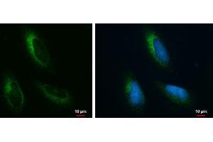 ICC/IF Image Grp78 antibody [N2C1], Internal detects Grp78 protein at endoplasmic reticulum by immunofluorescent analysis. (GRP78 抗体  (Internal Region))