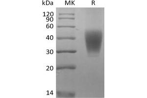 Western Blotting (WB) image for SLAM Family Member 7 (SLAMF7) protein (His tag) (ABIN7321032) (SLAMF7 Protein (His tag))