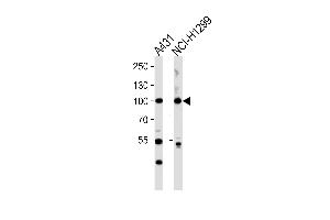 Western blot analysis of lysates from A431,NCI- cell line (from left to right),using FA13A (Cleaved-Gly39) Antibody (ABIN486738 and ABIN1536119). (FA13A (Cleaved-Gly39) 抗体)