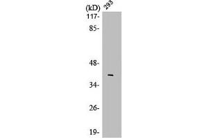 Western Blot analysis of 293 cells using LMO4 Polyclonal Antibody (LMO4 抗体  (C-Term))