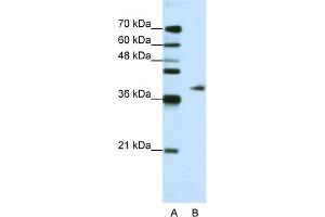WB Suggested Anti-ADAT1 Antibody Titration:  1. (ADAT1 抗体  (C-Term))