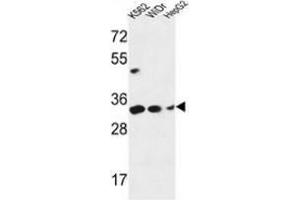 Western blot analysis of PYCR1 (arrow) in K562, WiDr, HepG2 cell line lysates (35ug/lane) using PYCR1  Antibody (C-term). (PYCR1 抗体  (C-Term))