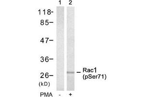Western blot analysis of extracts from 293 cells untreated(lane 1) or treated with PMA(lane 2) using Rac1(Phospho-Ser71) Antibody. (RAC1 抗体  (pSer71))