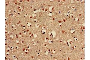 Immunohistochemistry (IHC) image for anti-ATP-Binding Cassette, Sub-Family A (ABC1), Member 2 (ABCA2) (AA 1223-1429) antibody (ABIN7144876)