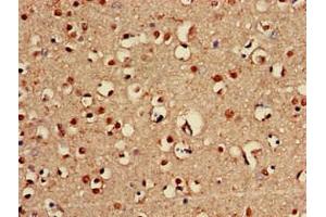 Immunohistochemistry of paraffin-embedded human brain tissue using ABIN7144876 at dilution of 1:100