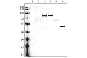 Lanes: 1:non-transfected cells, 2:V5-tagged empty plasmid, 3:protein A (V5-tagged), 4:protein B (V5-tagged), 5:protein C (V5-tagged), 6:protein D (V5-tagged), Protocol and data courtesy of Dr.