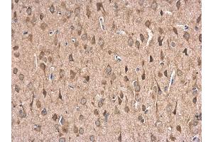 Immunohistochemistry (IHC) image for anti-Heat Shock 70kDa Protein 1B (HSPA1B) (Center) antibody (ABIN2856263)