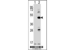 Western blot analysis of ILK using rabbit polyclonal ILK Antibody (pS246) using 293 cell lysates (2 ug/lane) either nontransfected (Lane 1) or transiently transfected (Lane 2) with the ILK gene. (ILK 抗体  (AA 225-253))