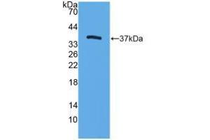 Western blot analysis of recombinant Mouse TFF3. (TFF3 抗体  (AA 23-81))