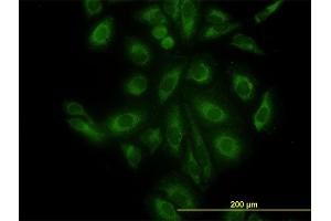 Immunofluorescence (IF) image for anti-ARP3 Actin-Related Protein 3 (ACTR3) (AA 1-418) antibody (ABIN564363)