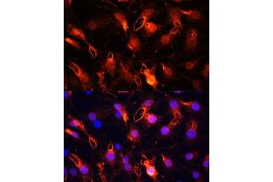 Immunofluorescence analysis of C6 cells using RNF149 Polyclonal Antibody (ABIN7270062) at dilution of 1:100 (40x lens). (RNF149 抗体  (AA 221-400))