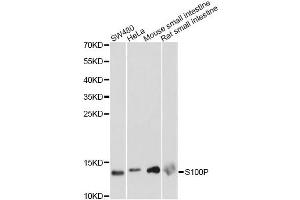 Western blot analysis of extracts of various cell lines, using S100P antibody. (S100P 抗体)