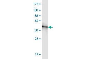 Western Blot detection against Immunogen (37. (RBM5 抗体  (AA 75-184))