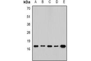Western blot analysis of RPLP1 expression in SW480 (A), mouse spleen (B), mouse brain (C), rat lung (D), rat liver (E) whole cell lysates. (RPLP1 抗体)