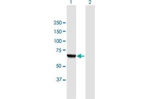 Western Blot analysis of PGM3 expression in transfected 293T cell line by PGM3 MaxPab polyclonal antibody. (Phosphoglucomutase 3 抗体  (AA 1-542))
