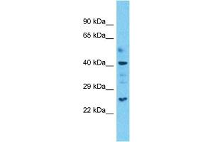 Host:  Rabbit  Target Name:  OLFML3  Sample Type:  Uterus Tumor lysates  Antibody Dilution:  1. (OLFML3 抗体  (N-Term))