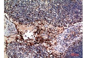 Immunohistochemistry (IHC) image for anti-Tumor Necrosis Factor (Ligand) Superfamily, Member 4 (TNFSF4) (Internal Region) antibody (ABIN6283257)