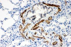 IHC-P: ATP2A2 antibody testing of rat lung tissue (ATP2A2 抗体  (N-Term))