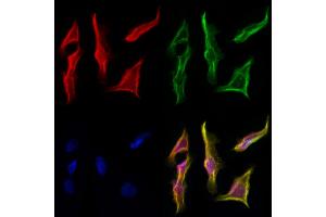 ABIN6257051 and ABIN6274616 staining Hela cells by IF/ICC. (CDCA3 抗体  (C-Term))