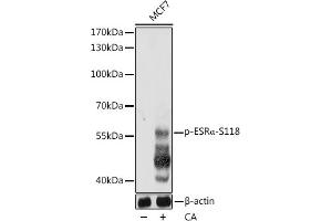 Western blot analysis of extracts of MCF7 cells, using Phospho-ESRα-S118 pAb  at 1:1000 dilution. (Estrogen Receptor alpha 抗体  (pSer118))