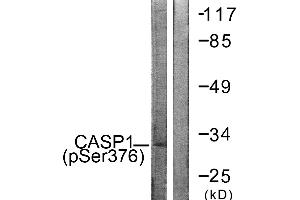 Immunohistochemistry analysis of paraffin-embedded human brain tissue using Caspase 1 (Phospho-Ser376) antibody. (Caspase 1 抗体  (pSer376))