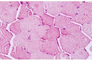Immunohistochemistry (IHC) image for anti-Protein tyrosine Phosphatase, Receptor Type, A (PTPRA) (Cytoplasmic Domain) antibody (ABIN1049270)