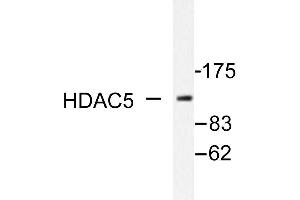 Image no. 1 for anti-Histone Deacetylase 5 (HDAC5) antibody (ABIN271892) (HDAC5 抗体)
