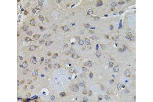 Immunohistochemistry of paraffin-embedded Rat brain using AURKC Polyclonal Antibody (Aurora Kinase C 抗体)