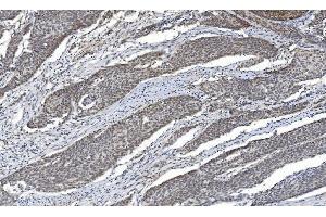 IHC analysis of HDAC5 using anti-HDAC5 antibody (ABIN7599922). (HDAC5 抗体  (AA 13-1107))