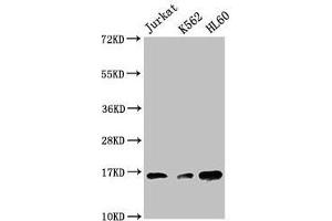 Western Blot Positive WB detected in: Jurkat whole cell lysate, K562 whole cell lysate, HL60 whole cell lysate All lanes: HIST1H3A antibody at 1:500 Secondary Goat polyclonal to rabbit IgG at 1/40000 dilution Predicted band size: 16 kDa Observed band size: 16 kDa (HIST1H3A 抗体  (3meLys27))