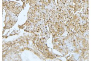ABIN6277269 at 1/100 staining Mouse muscle tissue by IHC-P. (FLIP 抗体  (Internal Region))