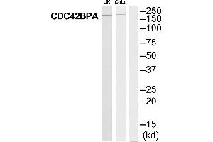 Western blot analysis of extracts from Jurkat/COLO205 cells, using MRCKa antibody. (CDC42BPA 抗体  (Internal Region))