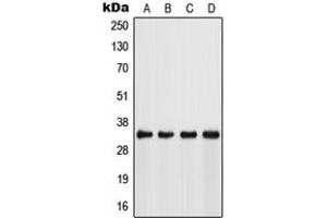 Western blot analysis of FSBP expression in Jurkat (A), HeLa (B), NIH3T3 (C), mouse stomach (D) whole cell lysates.