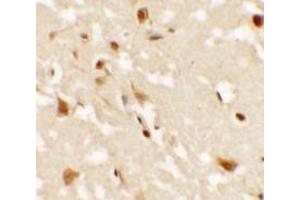 Immunohistochemistry of AIG1 in human brain tissue with AIG1 antibody at 2. (AIG1 抗体  (N-Term))