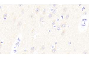 Detection of GP6 in Human Cerebrum Tissue using Polyclonal Antibody to Glycoprotein VI (GP6) (GP6 抗体  (AA 86-231))